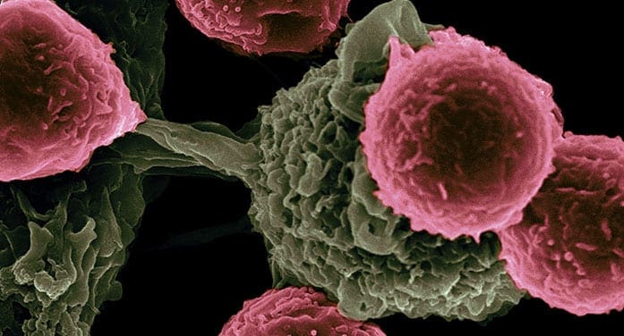 Marker may predict response to cancer immunotherapy