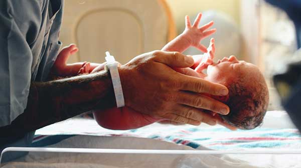 ‘Milking’ umbilical cord could benefit newborns breathing poorly